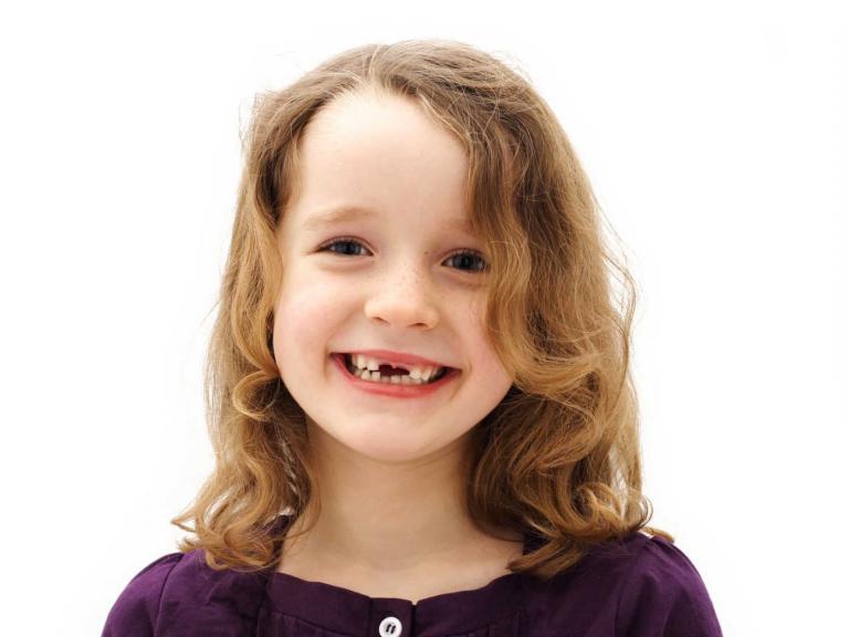 Teaser - Rubrik Zahnfee